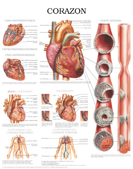 Ataque al corazón Ataque al corazón